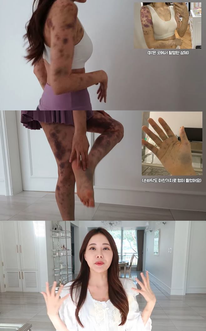 Ƽ̵ϸ 