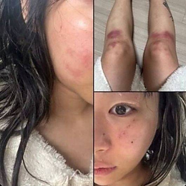 Ƽ���̵��ϸ� ����