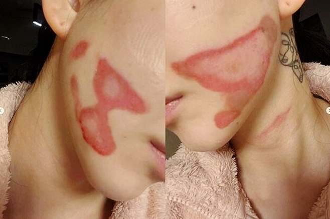 Ƽ���̵��ϸ� ����