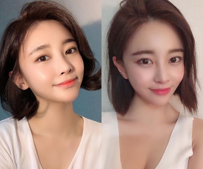 Àü¼³ÀÇ ¶óÀÌŸ