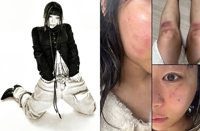 Ƽ���̵��ϸ� ����